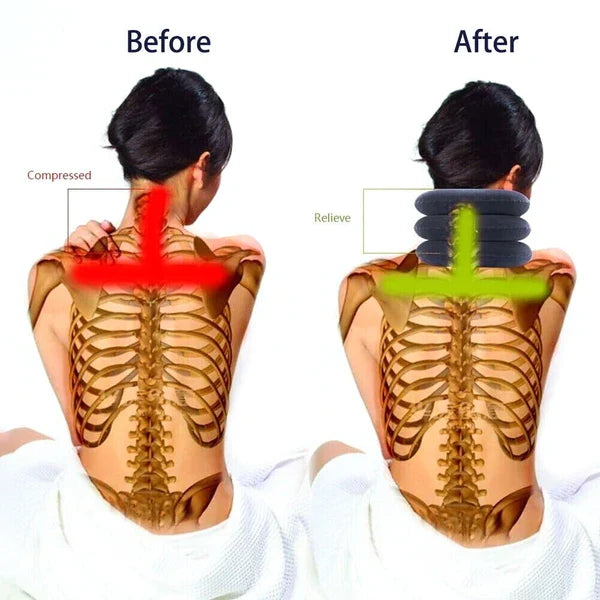 Inflatable Cervical Neck Traction Device Collar Support Stretcher Brace